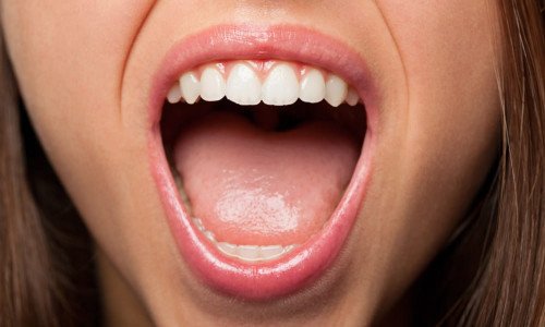 Кандидоз ротової порожнини: причини розвитку та фактори ризику
