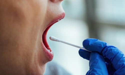 Мікрофлора ротової порожнини і роль пробіотиків у її відновленні